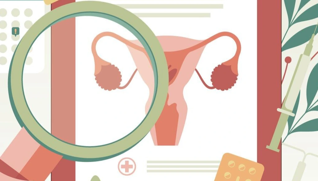 Raising Awareness of Ovarian Cancer